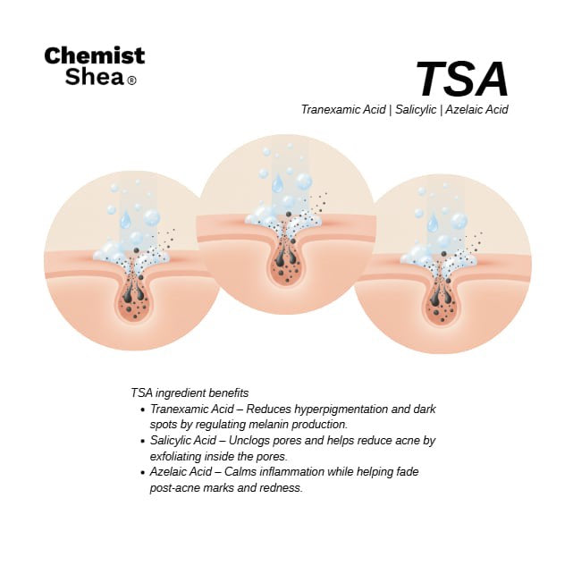 Chemist Shea Acne & Blemish Cleanser