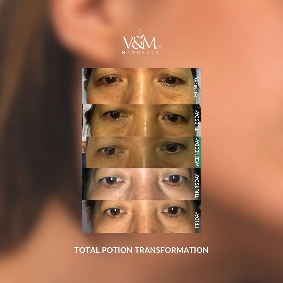 Total Potion